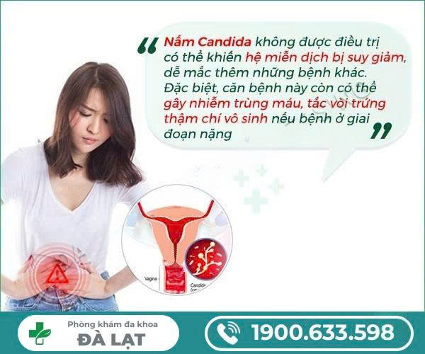 Hình ảnh minh họa